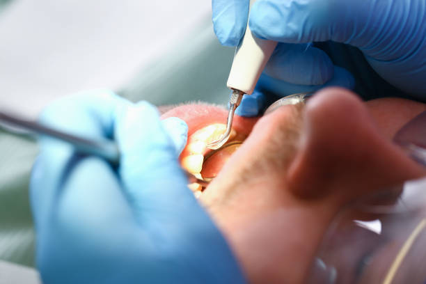 Best Cosmetic Emergency Dentistry in Prince Frederick, MD
