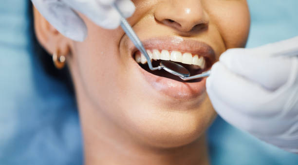 Best Pediatric Emergency Dentist in Prince Frederick, MD